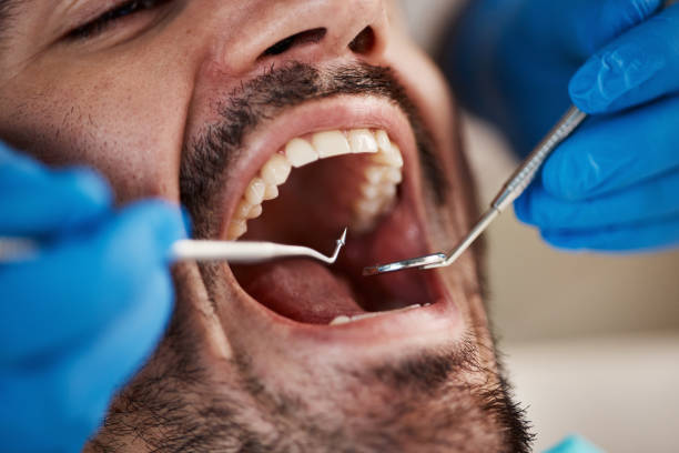 Best Emergency Treatment for Toothache in Arkansas City, KS
